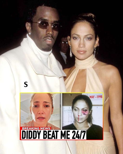 Jennifer Lopez COMES FORWARD That Diddy BEAT HER Just Like Cassie & Had FR3AK0FFS With Celebrities!
